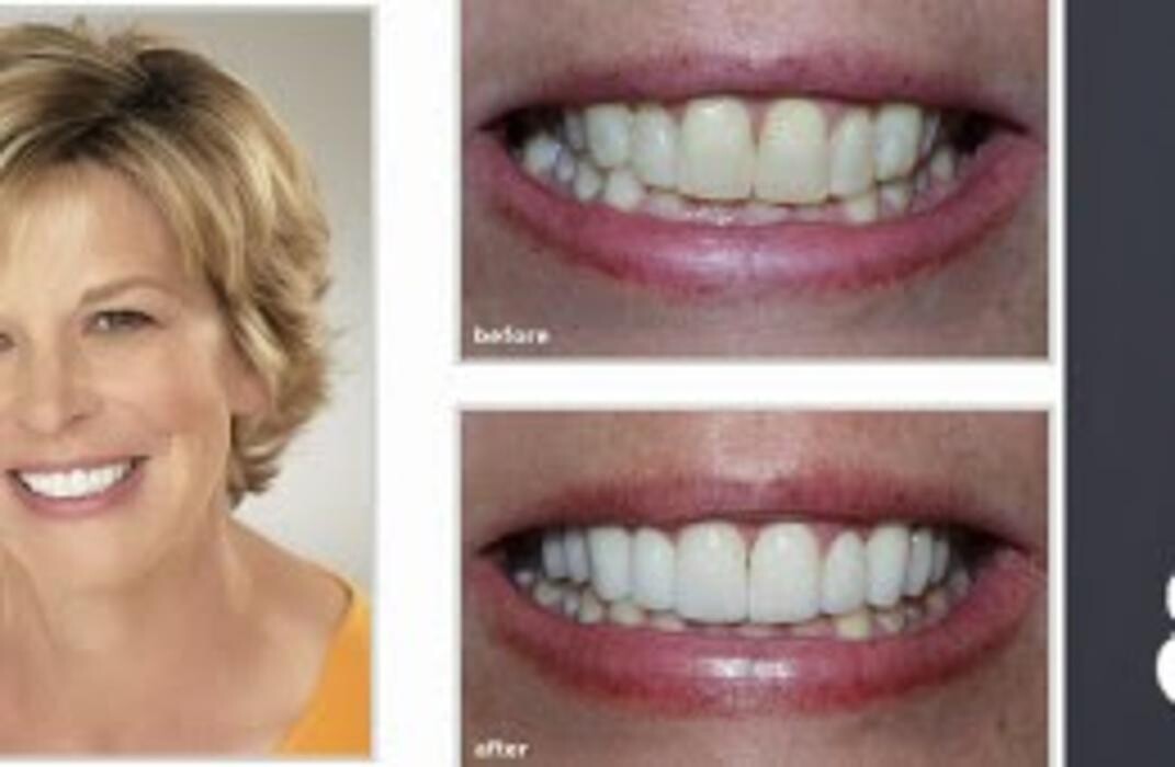 Images Brit Phillips, DDS