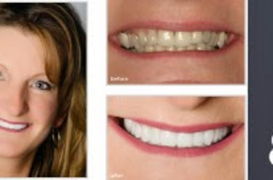 Images Brit Phillips, DDS