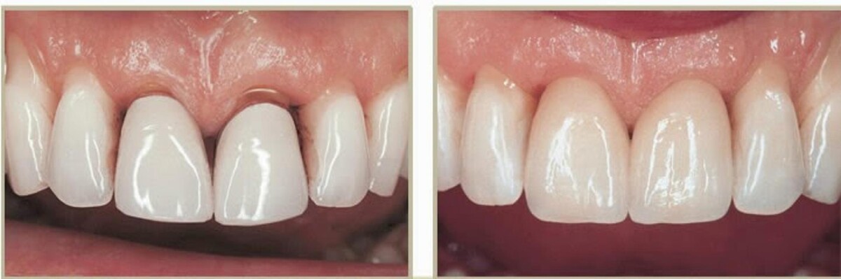 Images Brit Phillips, DDS