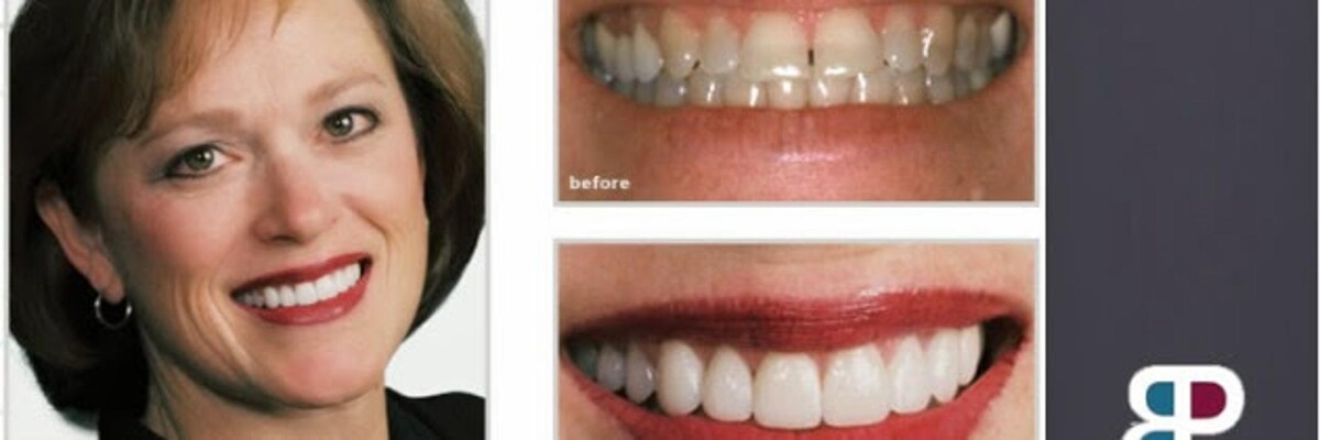 Images Brit Phillips, DDS
