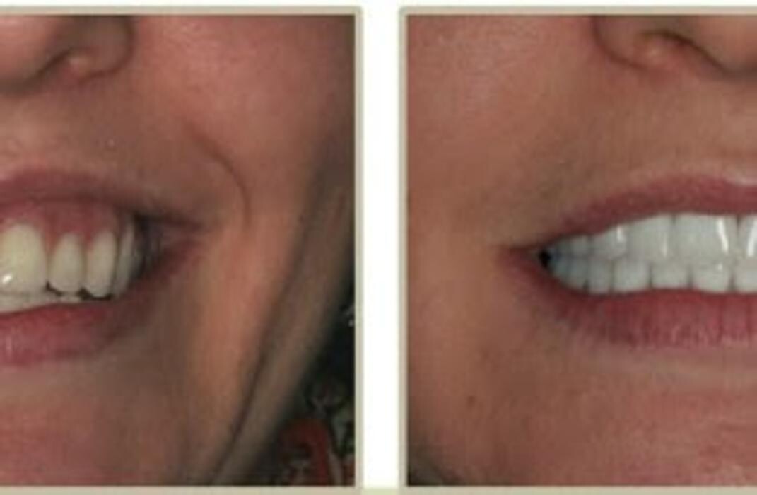 Images Brit Phillips, DDS