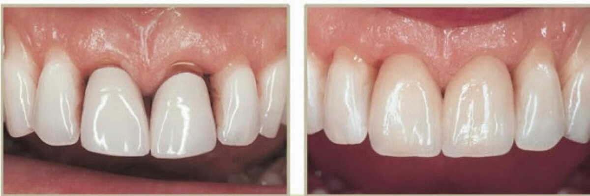 Images Brit Phillips, DDS