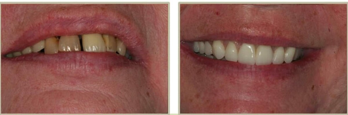Images Brit Phillips, DDS