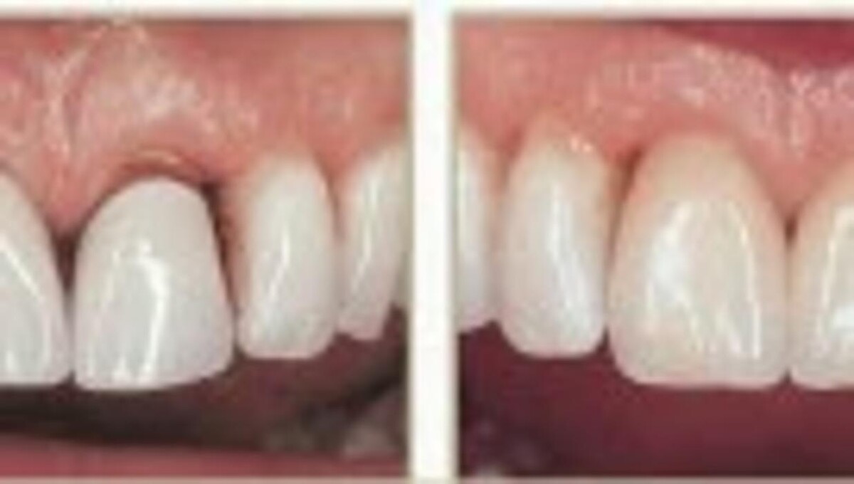 Images Brit Phillips, DDS