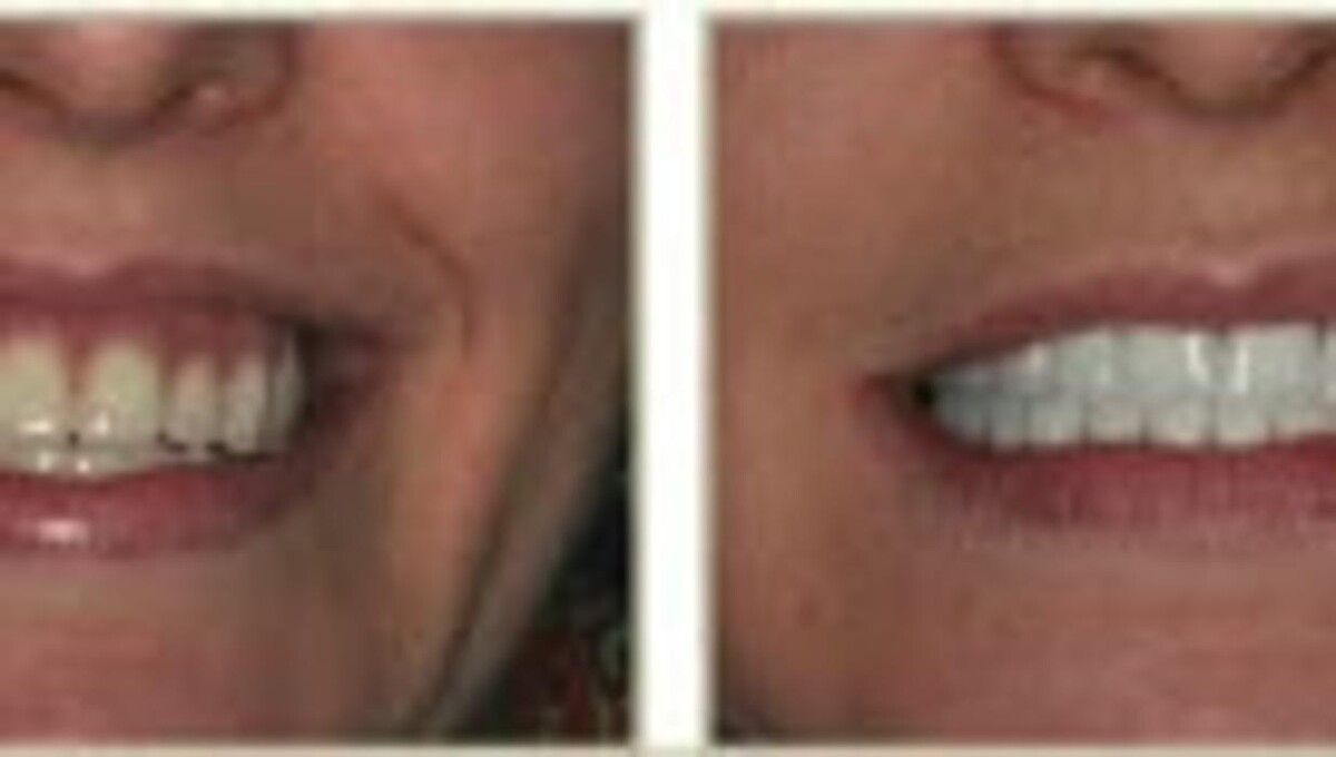 Images Brit Phillips, DDS