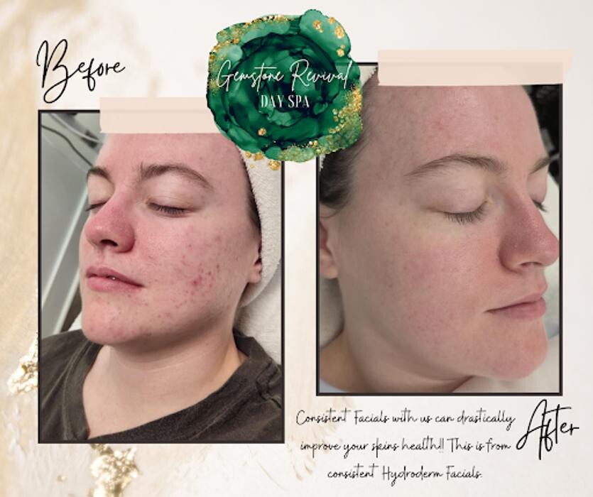 Images Gemstone Revival Day Spa