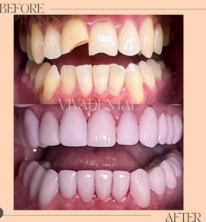 Images Viva Dental