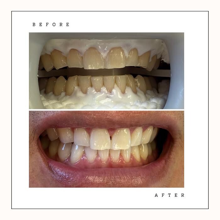 Images Dental Hygiene Care