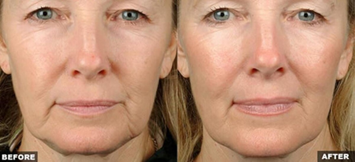 Images Pūr Skin Clinic