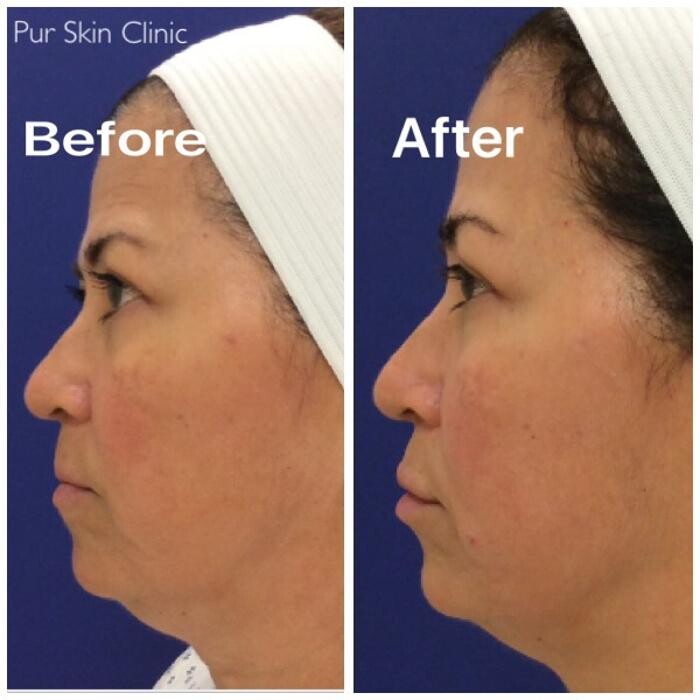 Images Pūr Skin Clinic