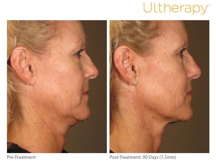 Images Pūr Skin Clinic