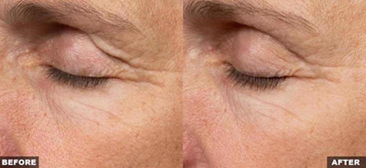 Images Pūr Skin Clinic