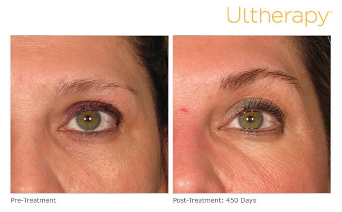 Images Pūr Skin Clinic