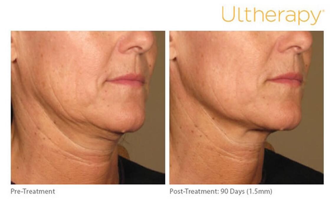 Images Pūr Skin Clinic