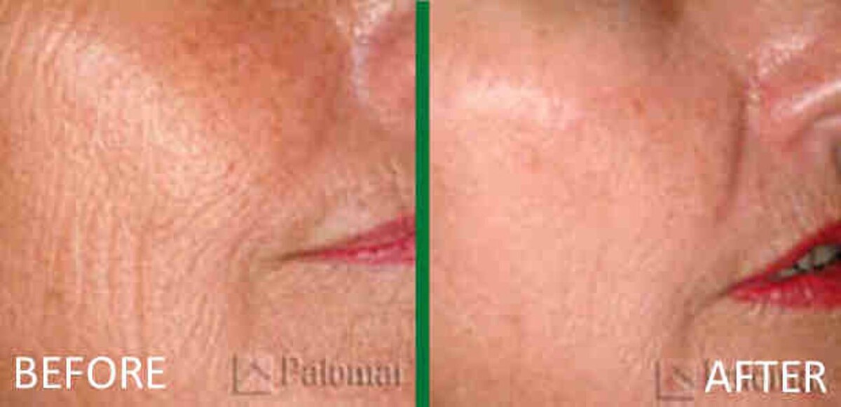 Images Pūr Skin Clinic