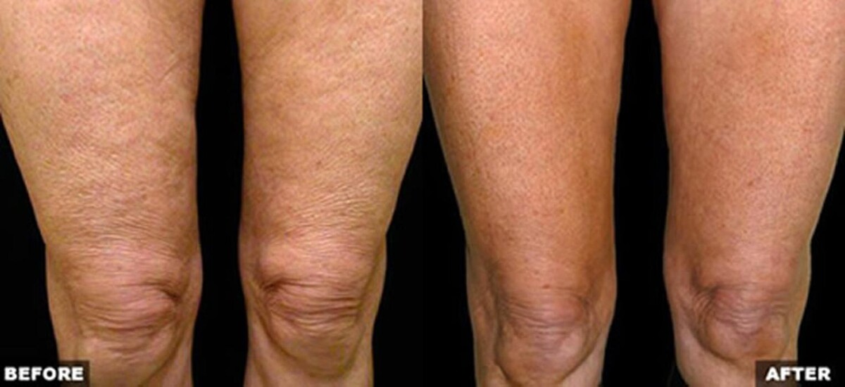 Images Pūr Skin Clinic