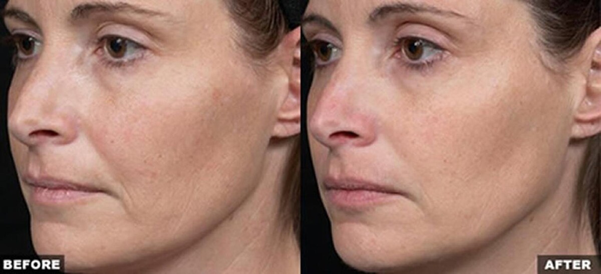 Images Pūr Skin Clinic