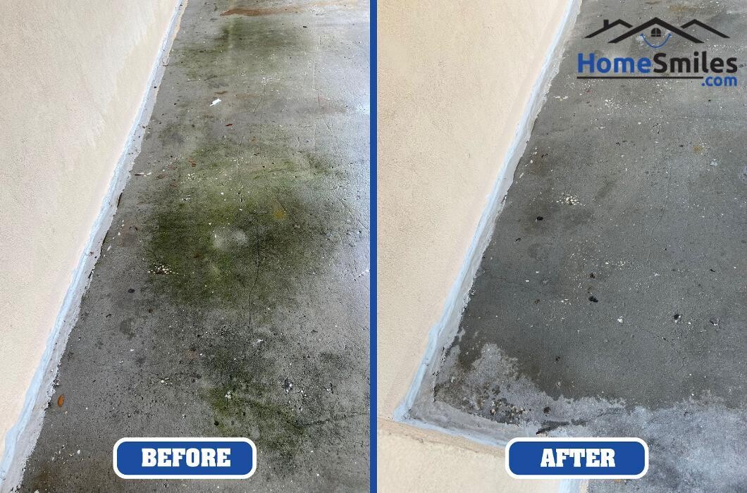 Images HomeSmiles Metro Houston