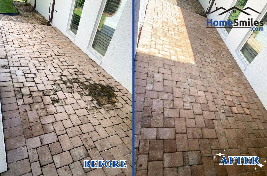 Images HomeSmiles Metro Houston