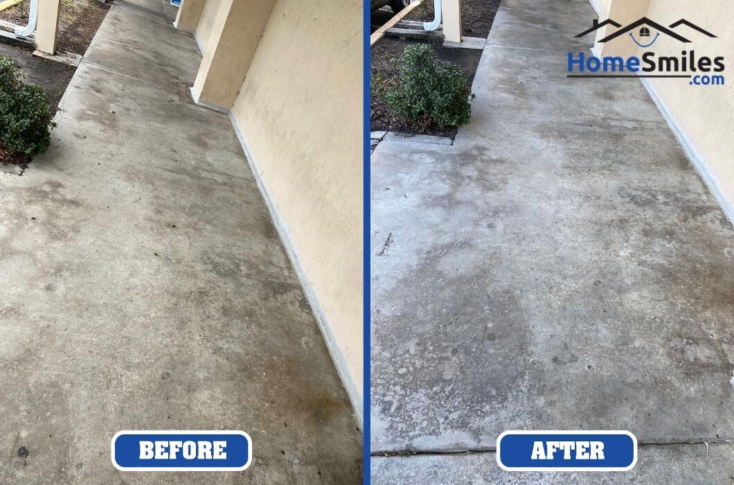 Images HomeSmiles Metro Houston