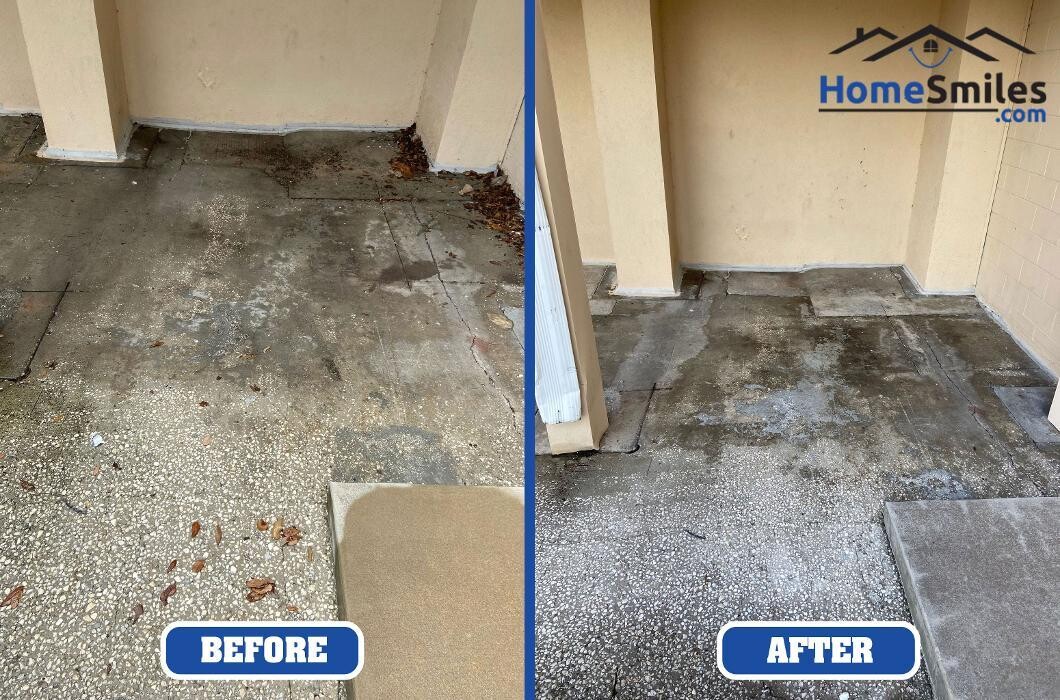 Images HomeSmiles Metro Houston