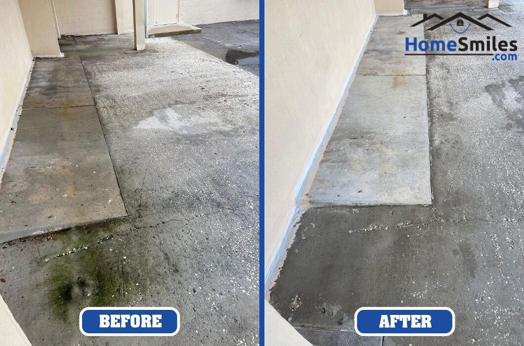 Images HomeSmiles Metro Houston