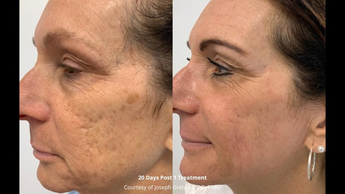 Images Experience Dermatology