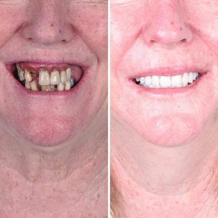 Images Britely Dentures + Implants Studio