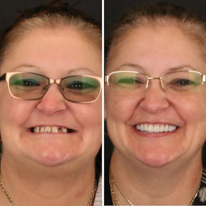 Images Britely Dentures + Implants Studio