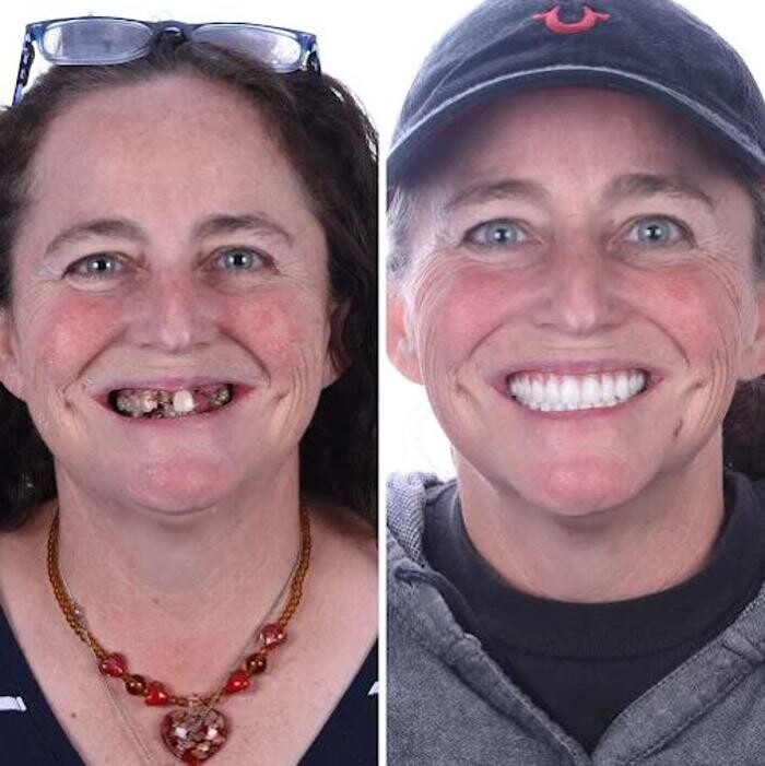 Images Britely Dentures + Implants Studio