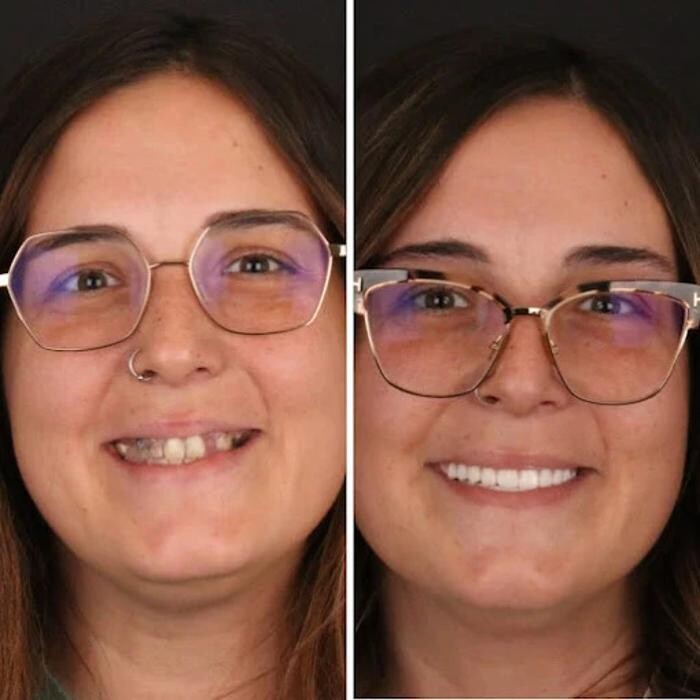 Images Britely Dentures + Implants Studio