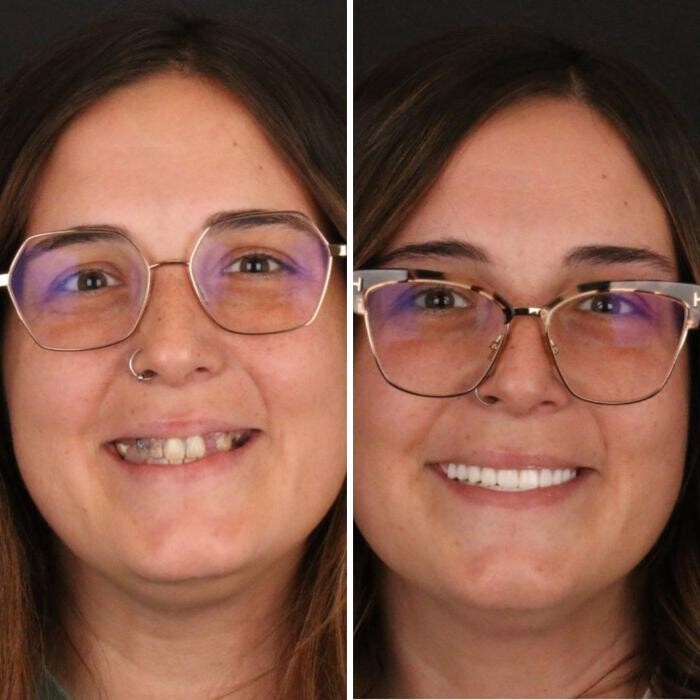 Images Britely Dentures + Implants Studio