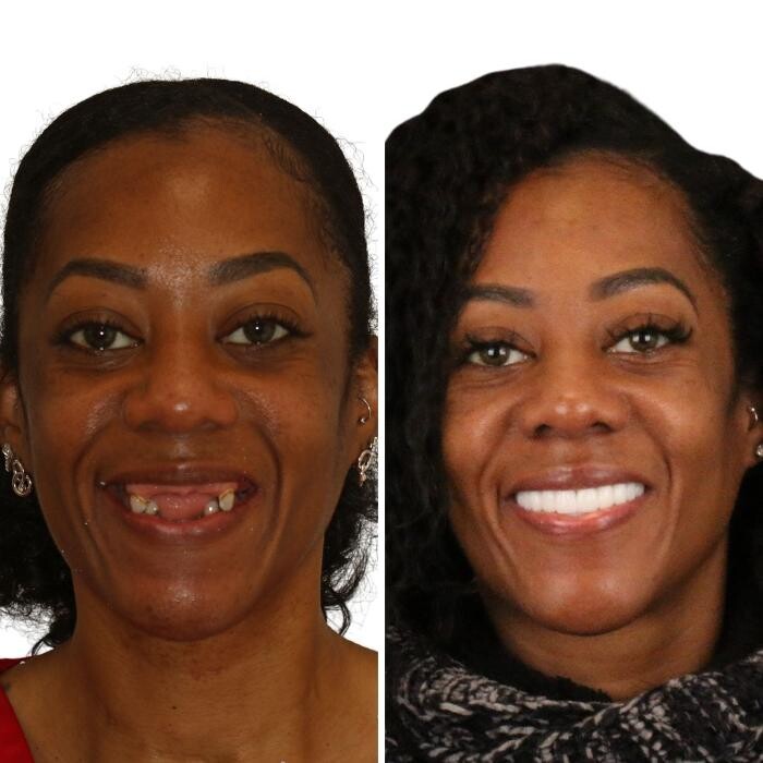 Images Britely Dentures + Implants Studio