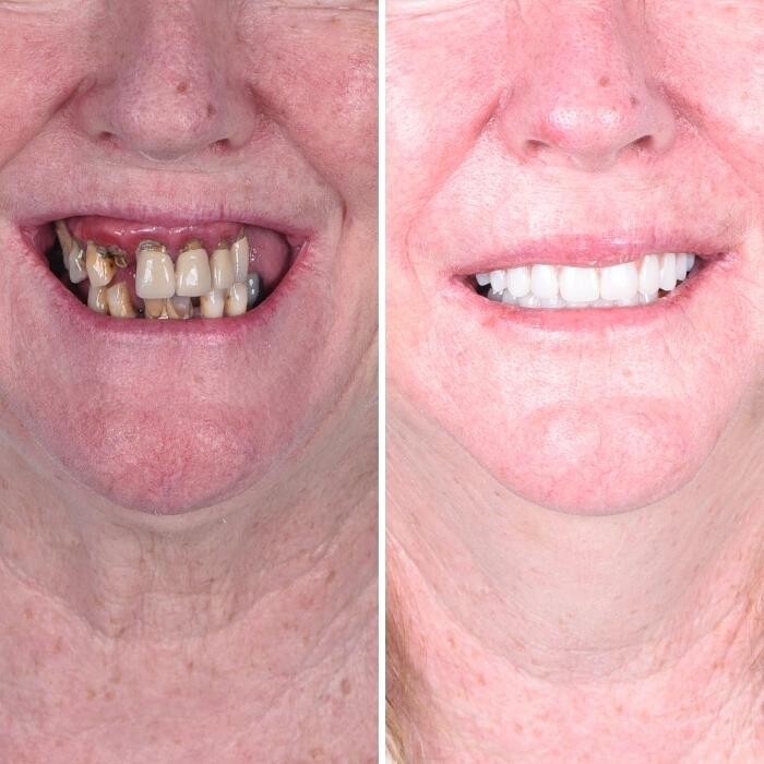 Images Britely Dentures + Implants Studio