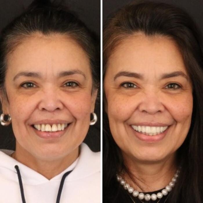 Images Britely Dentures + Implants Studio