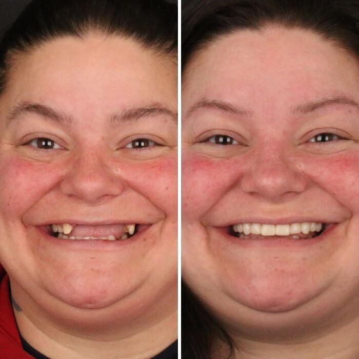 Images Britely Dentures + Implants Studio