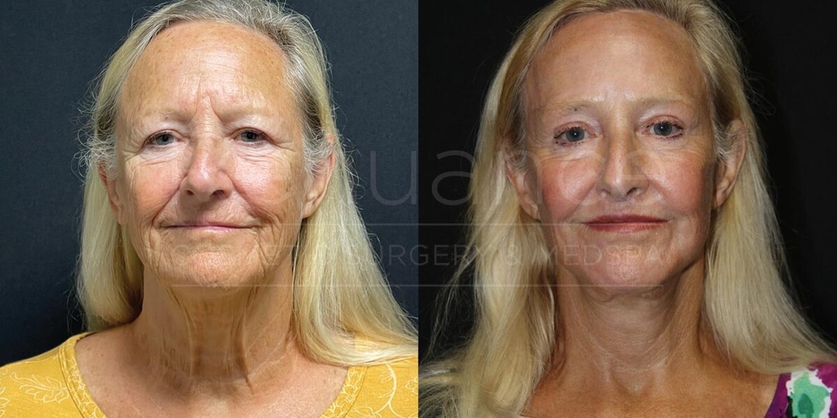 Images Renuance Cosmetic Surgery & MedSpa - Rancho Bernardo