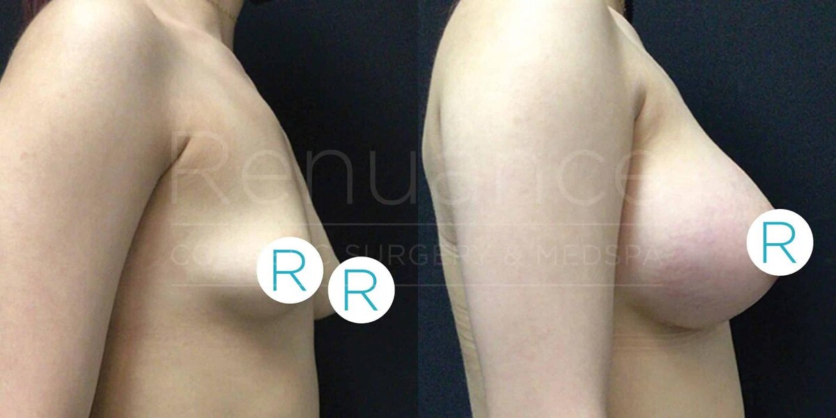 Images Renuance Cosmetic Surgery & MedSpa - Rancho Bernardo