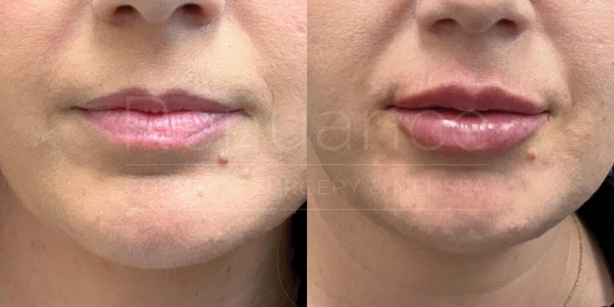 Images Renuance Cosmetic Surgery & MedSpa - Rancho Bernardo