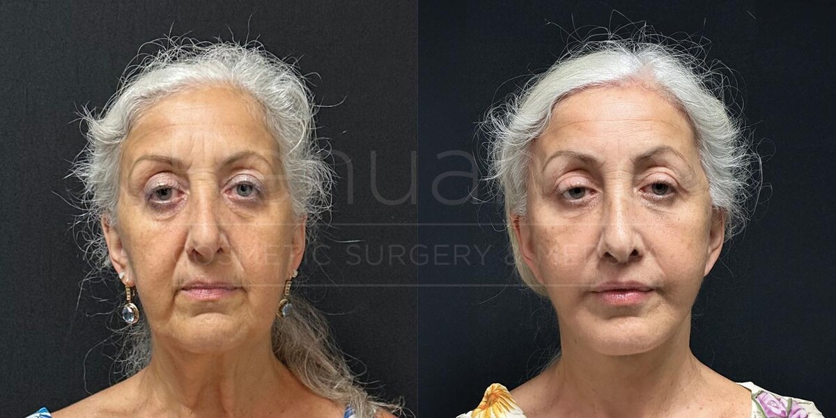 Images Renuance Cosmetic Surgery & MedSpa - Rancho Bernardo