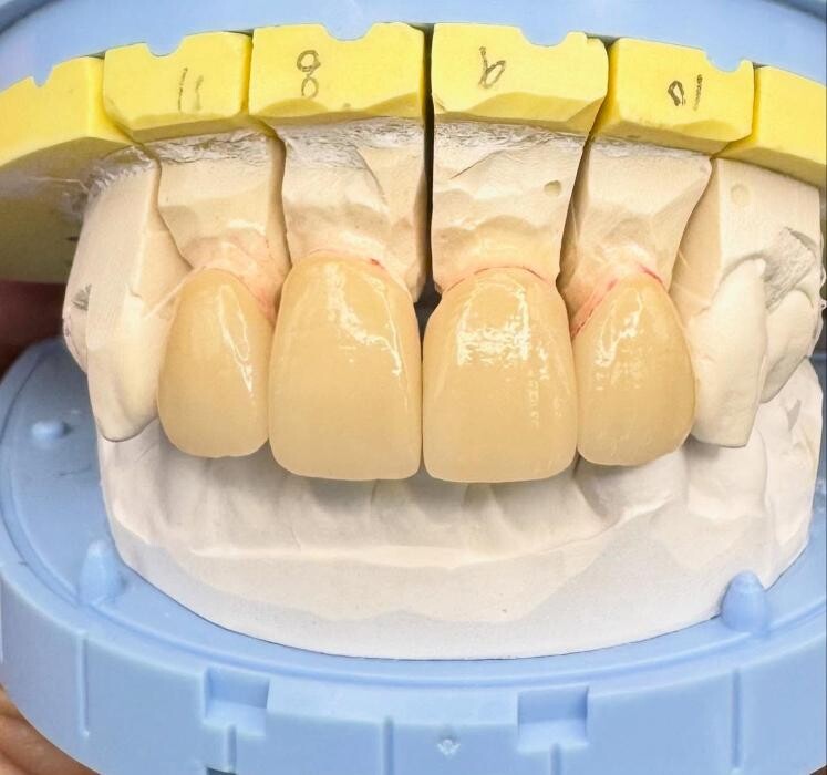 Images HiTec Dental Ceramics