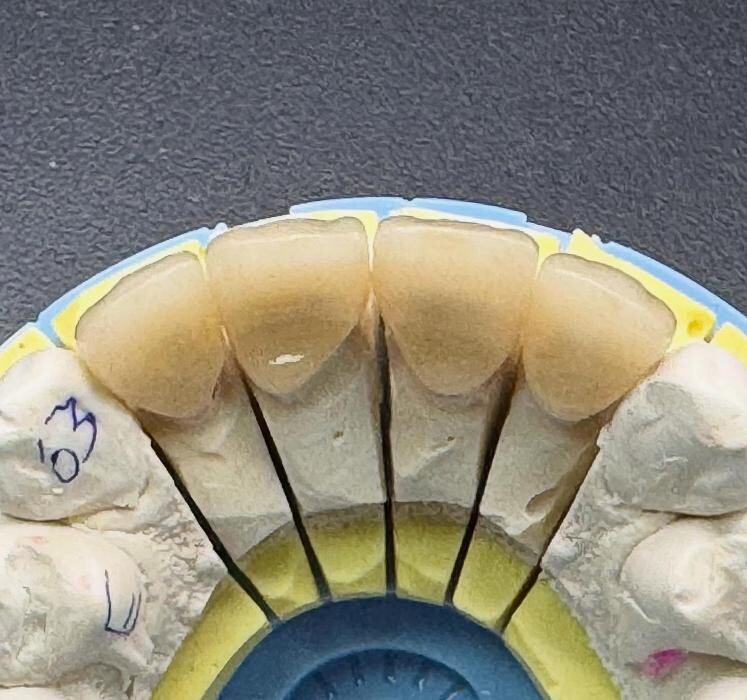 Images HiTec Dental Ceramics