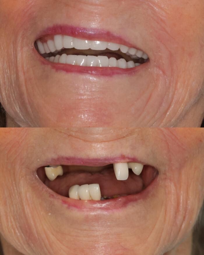 Images Boyechko Dental