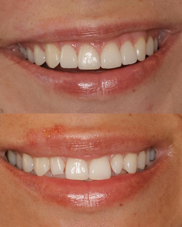 Images Boyechko Dental