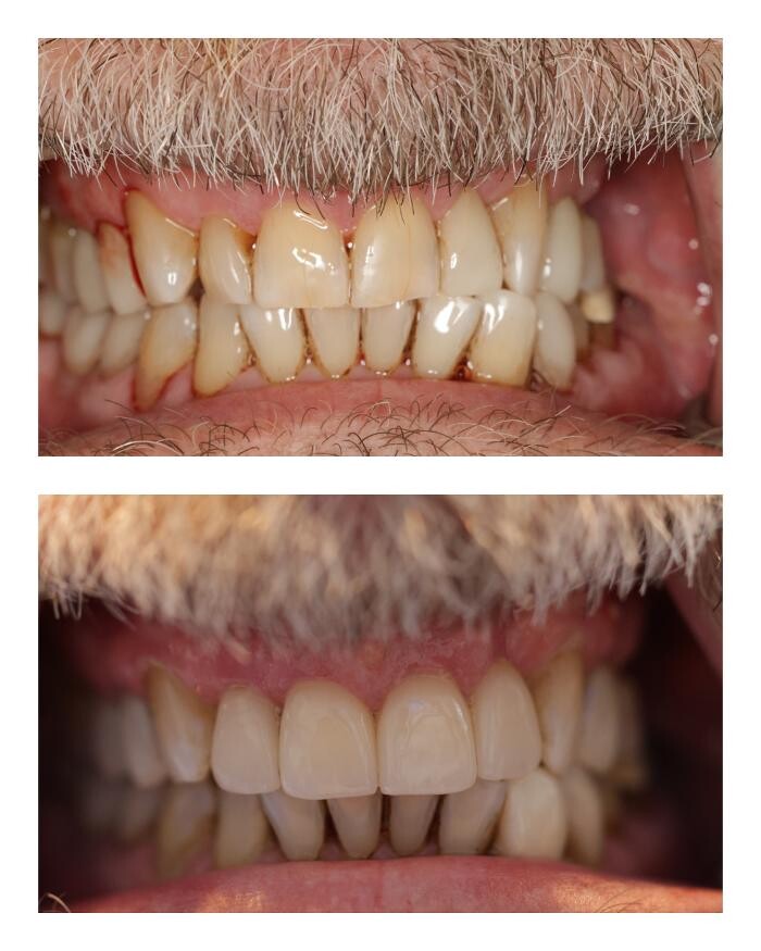 Images Boyechko Dental