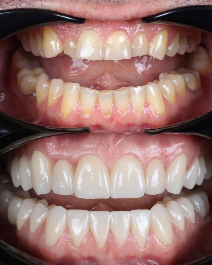 Images Boyechko Dental