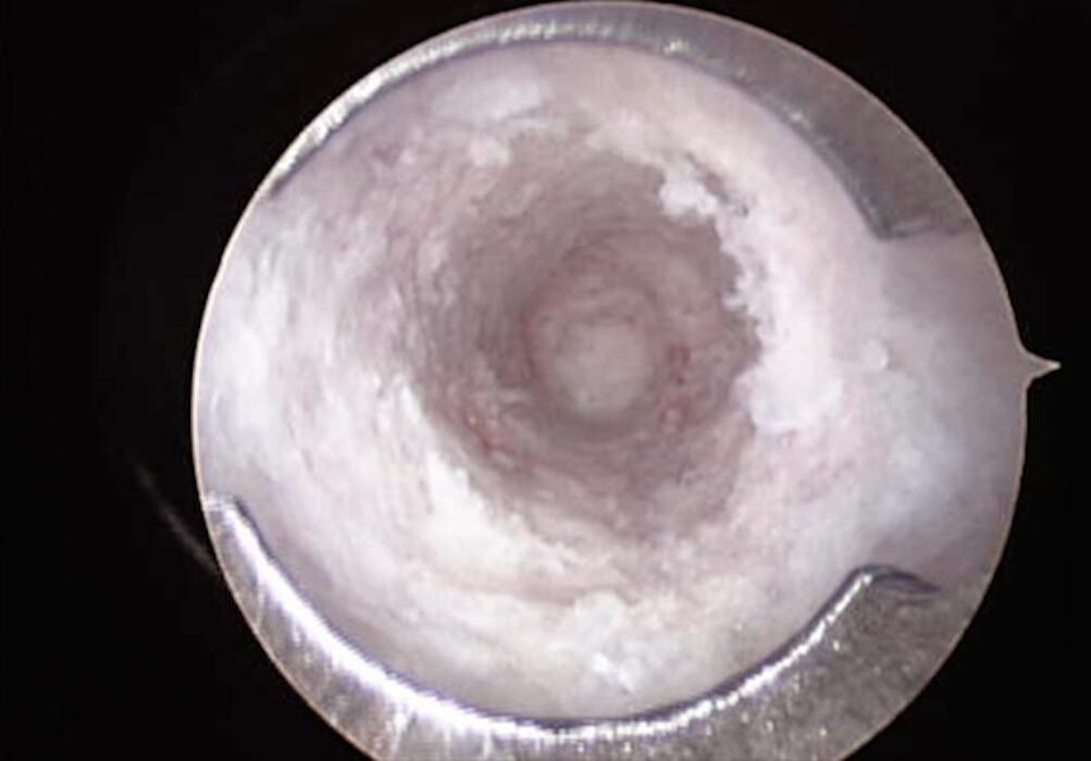 Images Progressive Spine & Orthopaedics - Dr Kris Radcliff - Somers Point