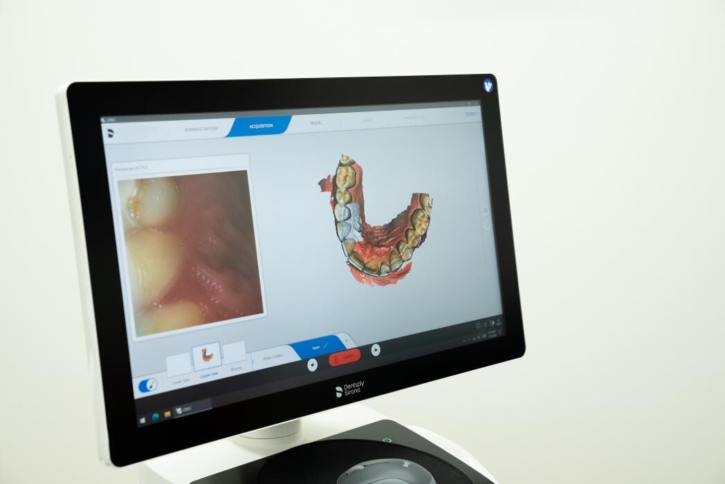 Images Only Crowns - Las Vegas