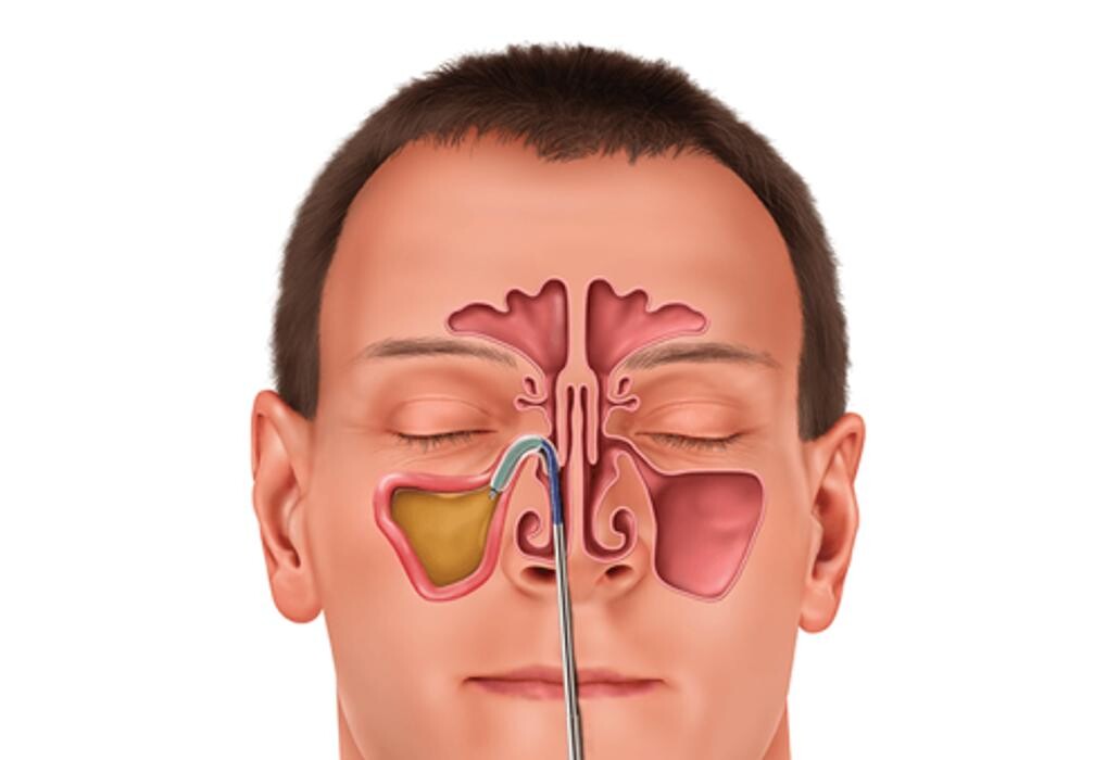 Images Freedman ENT Downriver - Dr. Michael Freedman