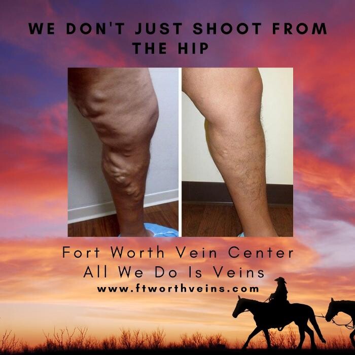 Images Fort Worth Vein Center | Dr. Barry Oswalt, now part of CVR